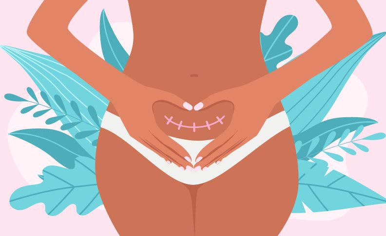 Kako carski porod utječe na menstruaciju? Evo mišljenja ginekologinje