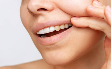 Ovo su tri glavna uzroka zašto nam zubi gube bjelinu
