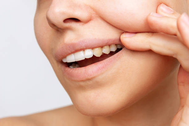 Ovo su tri glavna uzroka zašto nam zubi gube bjelinu